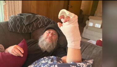 Carpenter survives machete attack from road rage driver in Carlsbad – NBC 7 San Diego