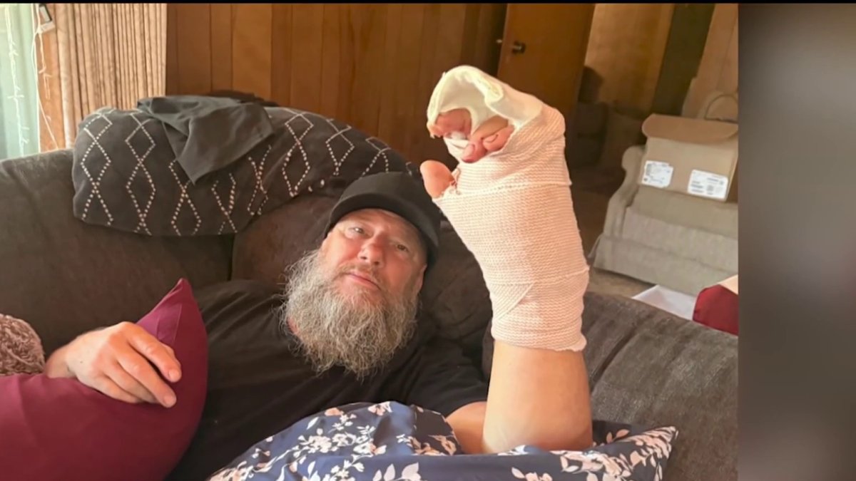 Carpenter survives machete attack from road rage driver in Carlsbad – NBC 7 San Diego