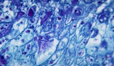 New strain of mpox detected in San Francisco – NBC Bay Area