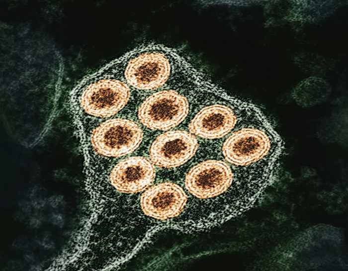 Skunk tests positive for rabies after biting resident in Oakland County
