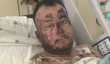 Father severely burned after getting caught in live wires during daughter’s cat rescue in Tijuana – NBC 7 San Diego