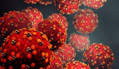 Orange County measles case confirmed in infant after travel – NBC Los Angeles