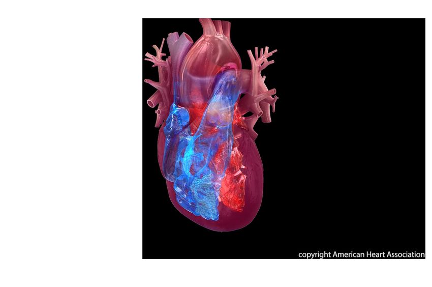 Methamphetamine use linked to 1 in 6 heart attacks in California study