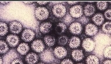 High levels of rotavirus in some Bay Area cities – NBC Bay Area
