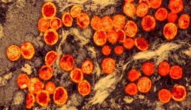 Small circular patterns float in a dense, thick brown substance.