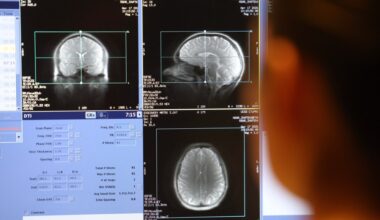 UCSD marijuana study affirms drug’s negative effect on youth – San Diego Union-Tribune