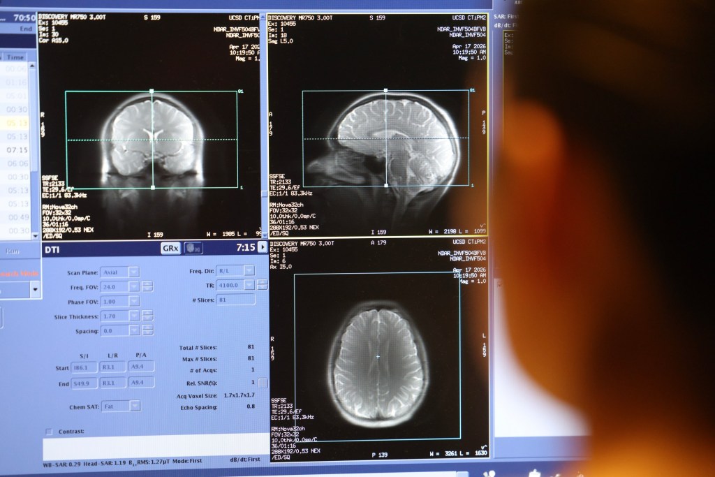 UCSD marijuana study affirms drug’s negative effect on youth – San Diego Union-Tribune