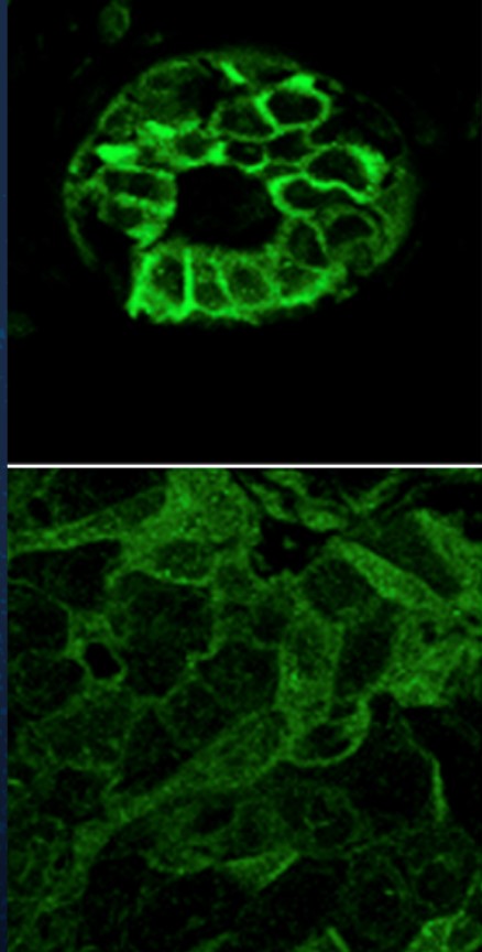 UCSD study focuses on role of type of protein in breast cancer – San Diego Union-Tribune