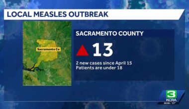 Sacramento County confirms two new measles cases in young patients