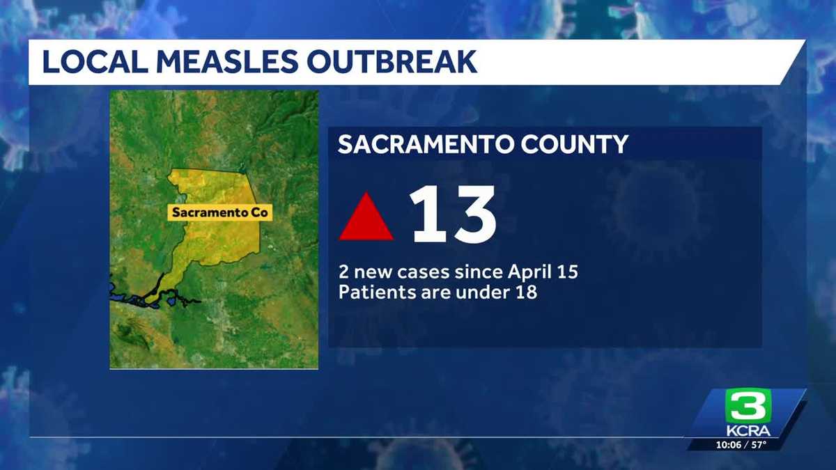 Sacramento County confirms two new measles cases in young patients