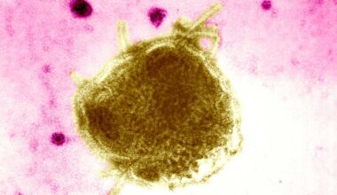 Sacramento County confirms 2 additional measles cases