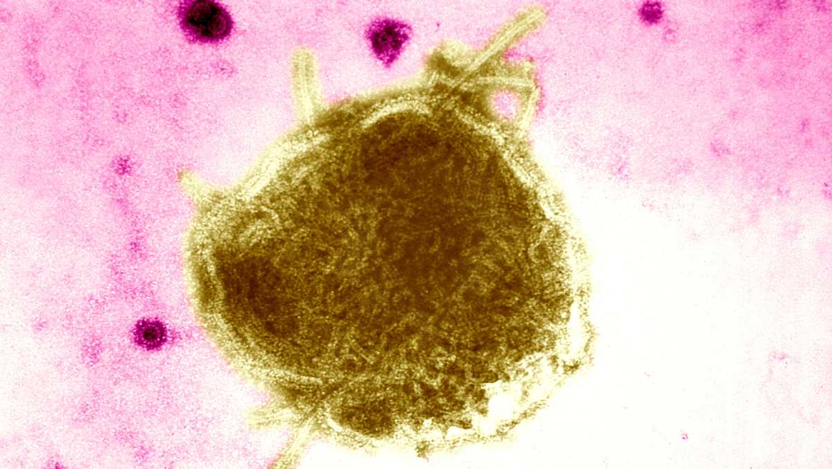 Sacramento County confirms 2 additional measles cases