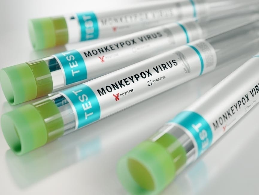 Mpox Cases Soar In CA As Rare Strain Detected For First Time In San Francisco