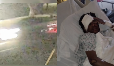 Bakersfield police seek the driver in a hit-and-run that injured a teen