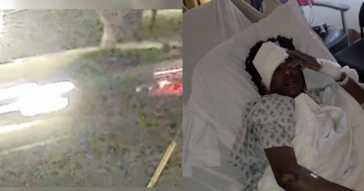 Bakersfield police seek the driver in a hit-and-run that injured a teen