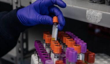 Contributor: A sex test for Olympic contenders harms all women