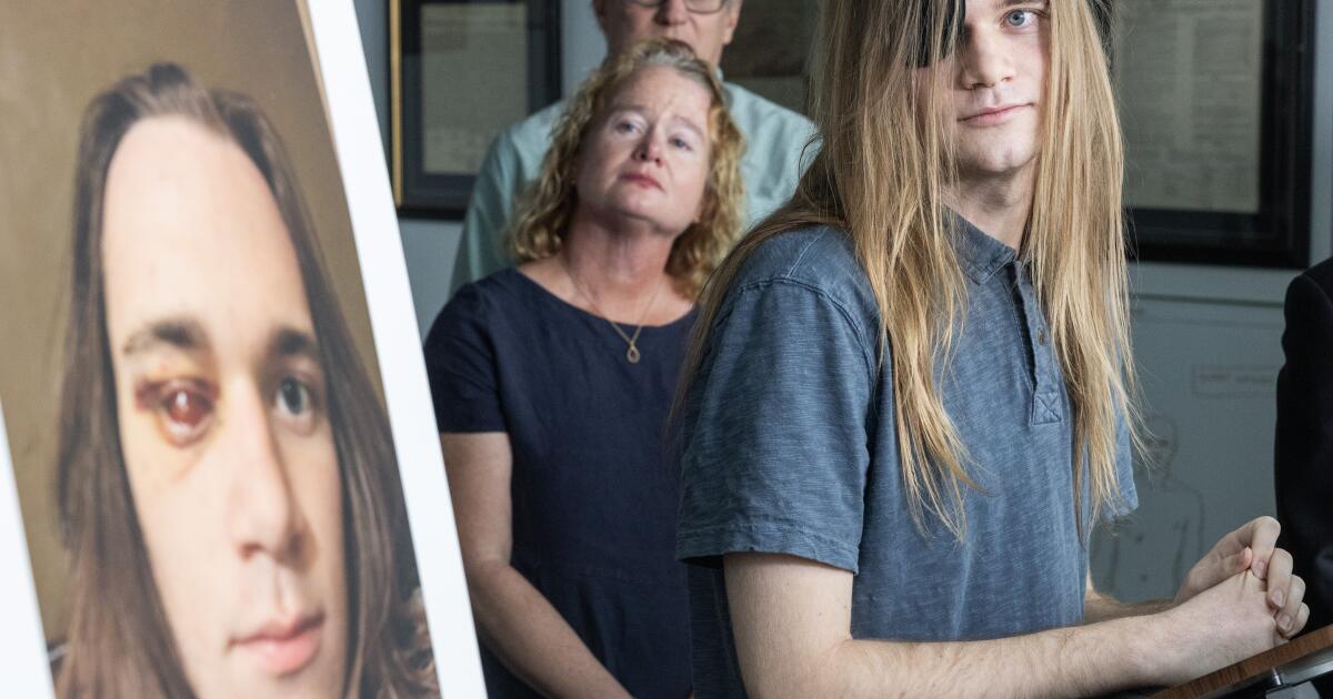 An immigration agent shot out his eye at a 'No Kings' rally. His lawyers plan to file claim against Homeland Security