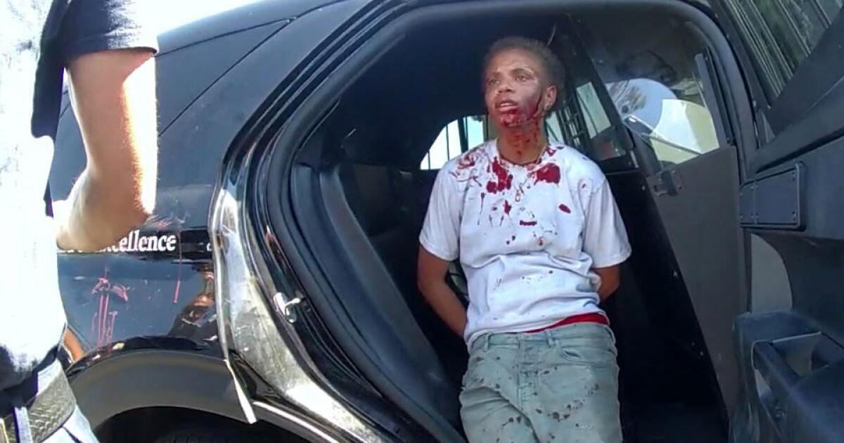 San Bernardino Police slammed handcuffed teen to the ground, lawsuit says