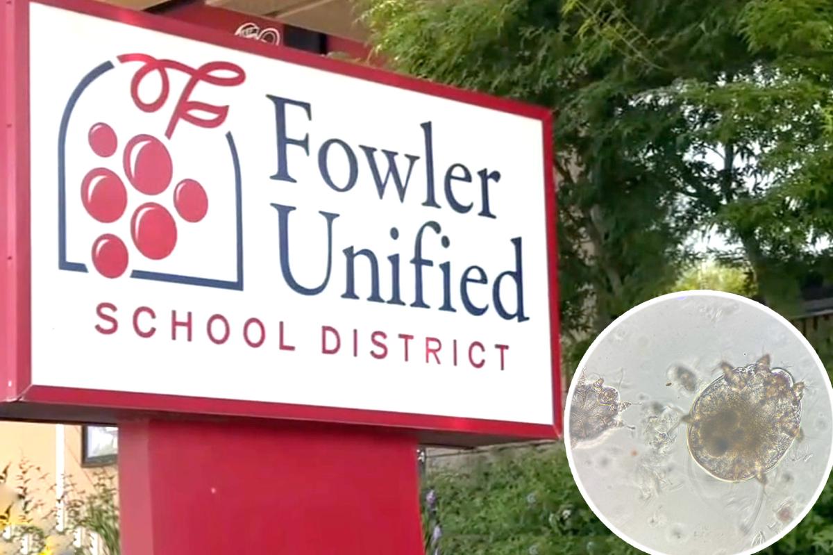 Suspected scabies cases reported in Fresno County’s Fowler Unified School District