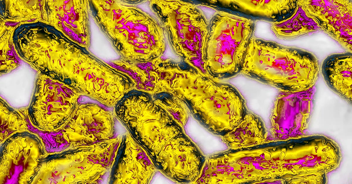 Legionella bacteria detected at Kaiser Permanente Santa Clara