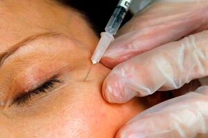 Study: Washington beats California as the most cosmetic surgery-obsessed state