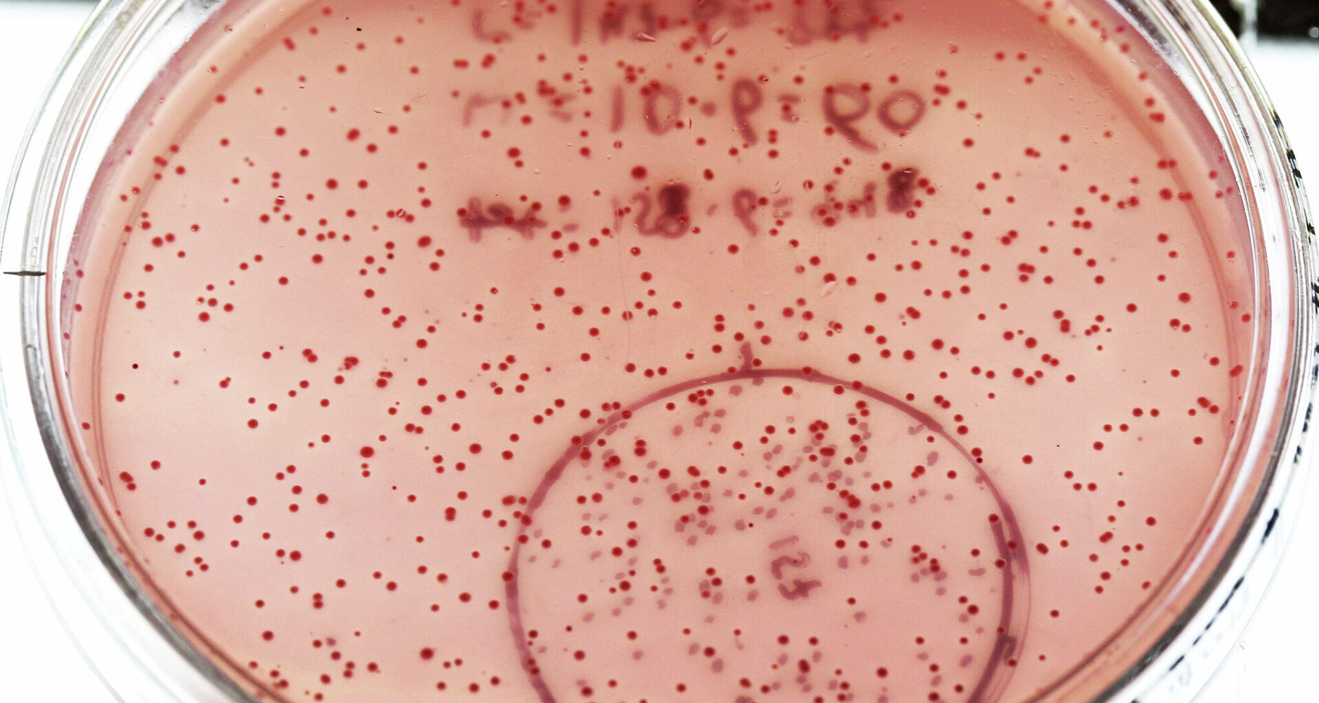 E. coli outbreak linked to California restaurant chain sickens 9