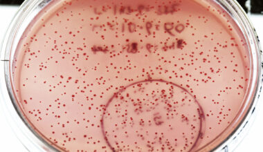 E. coli outbreak linked to California restaurant chain sickens 9