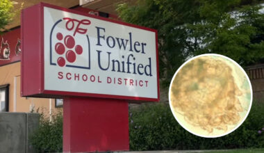 Fresno County confirms suspected scabies outbreak at Fowler school
