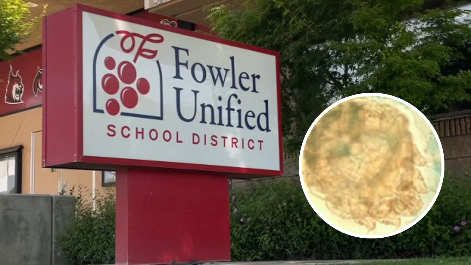Fresno County confirms suspected scabies outbreak at Fowler school