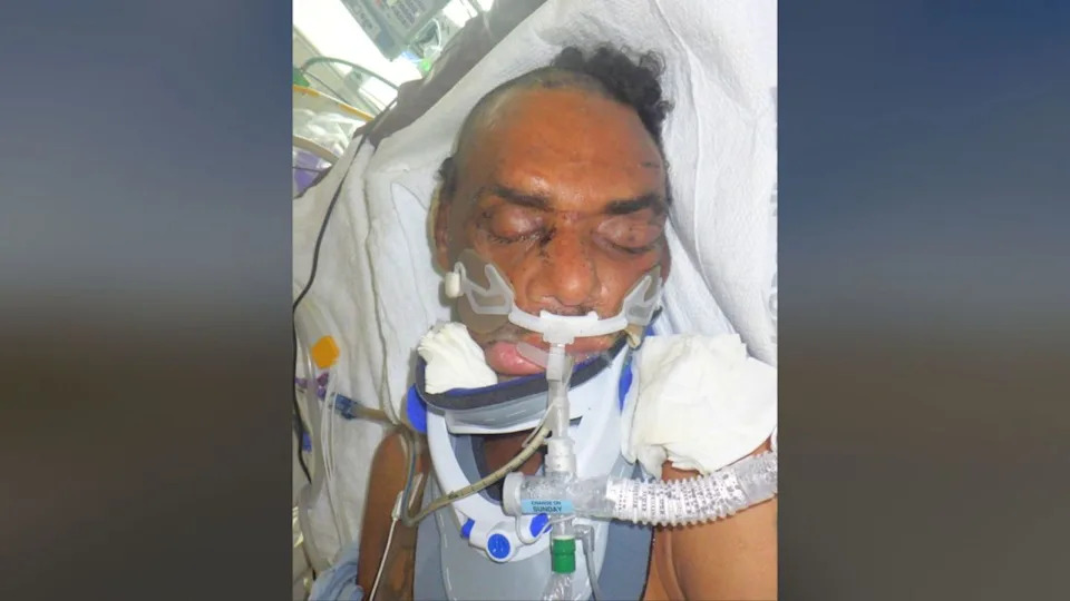 A male patient in his mid-40s was found injured near E. Olympic Boulevard and S. Santa Fe Avenue in downtown Los Angeles on May 8, 2026. (Los Angeles General Medical Center)