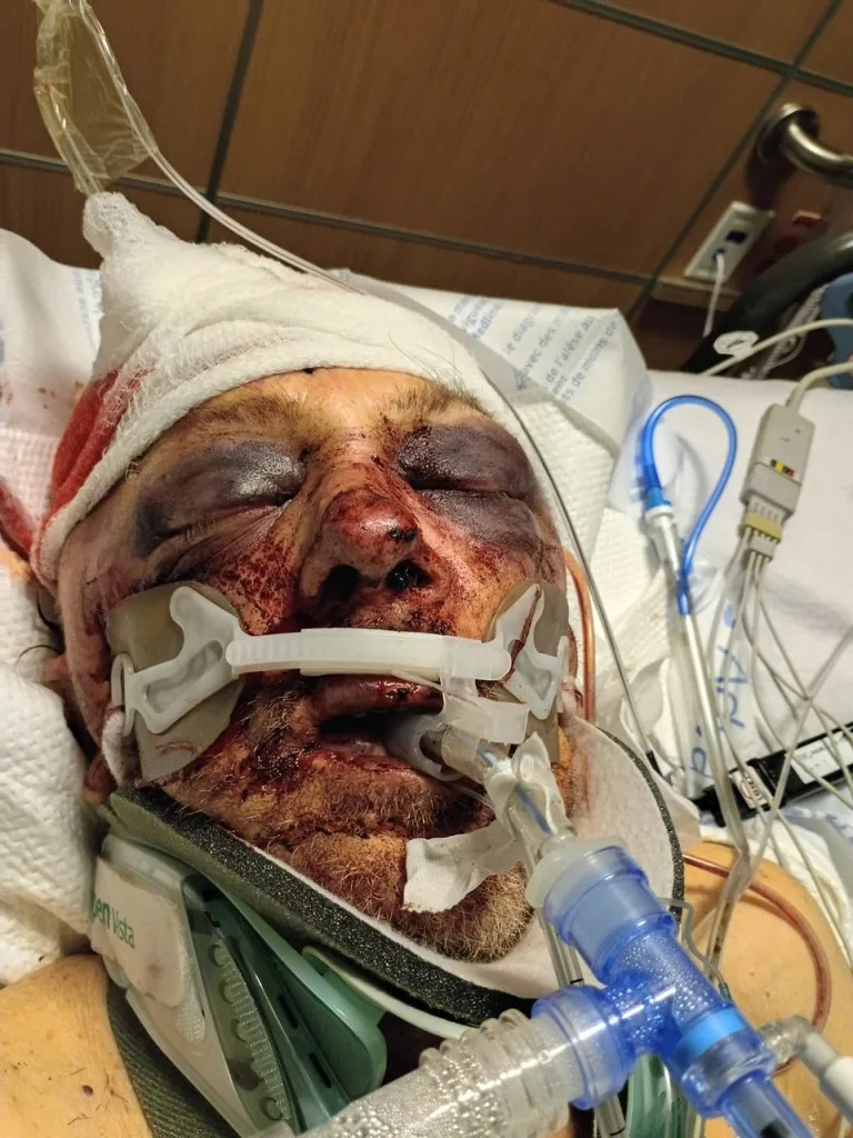 Sheron’s wife said there’s no hope for her husband following the brutal attack. Obtained by CA Post