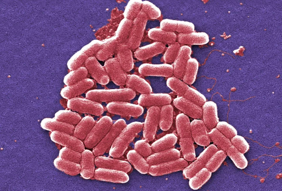 The Kebab Shop said Sunday it has severed ties with Olympia Foods following the outbreak investigation. AP
