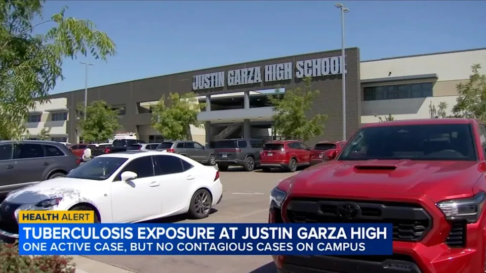 Fresno County officials confirmed a TB exposure at Justin Garza High School, where one active infection was identified. ABC 30
