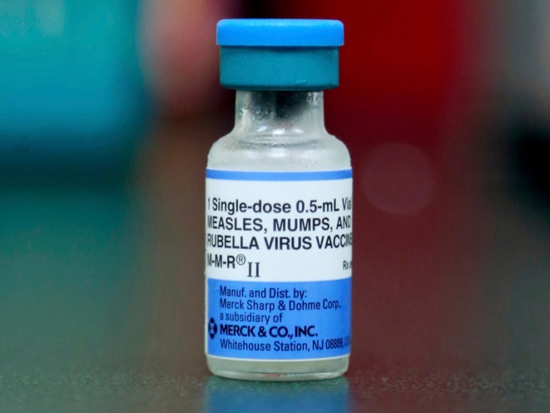 Update: Possible mumps exposure at 2 Berkeley schools, but city says risk of community transmission is ‘very low’