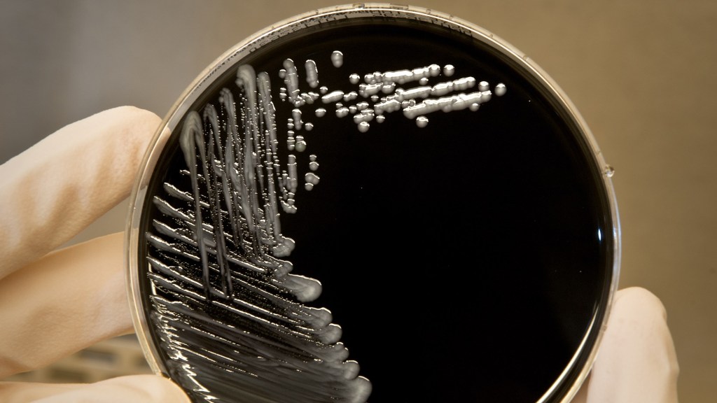 18 cases of legionella, water-borne bacteria, found at Kaiser Santa Clara hospital – The Press Democrat