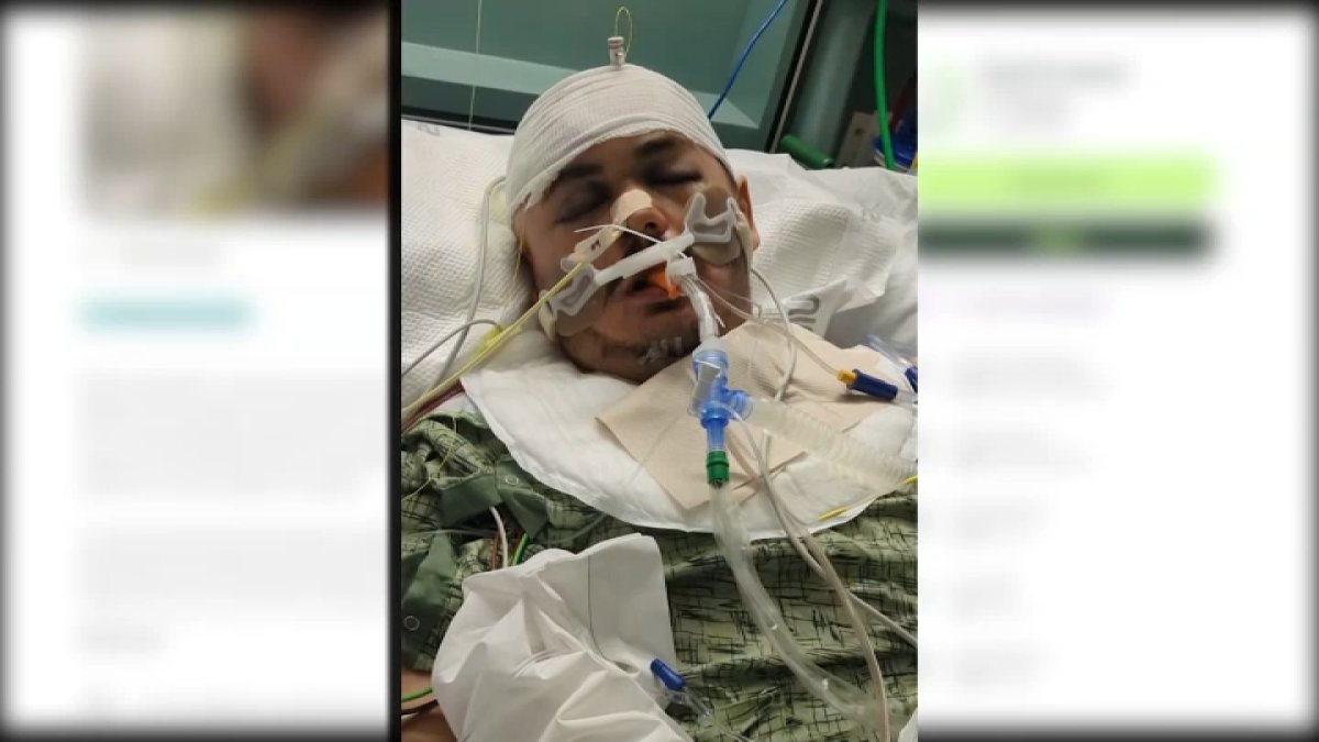 City Heights man suffers brain damage after brutal attack – NBC 7 San Diego