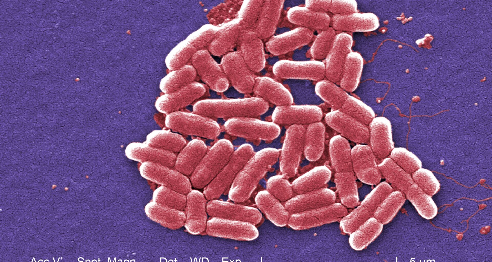 County Reports Two Local Cases in Statewide Kebab Shop E.Coli Outbreak  | News