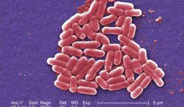 County Reports Two Local Cases in Statewide Kebab Shop E.Coli Outbreak  | News