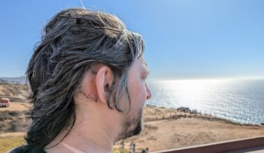 UCSD patient returns to making music after removal of rare inner-ear tumor – San Diego Union-Tribune
