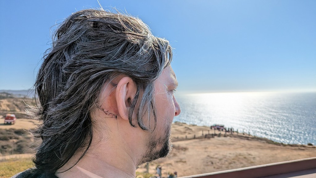 UCSD patient returns to making music after removal of rare inner-ear tumor – San Diego Union-Tribune