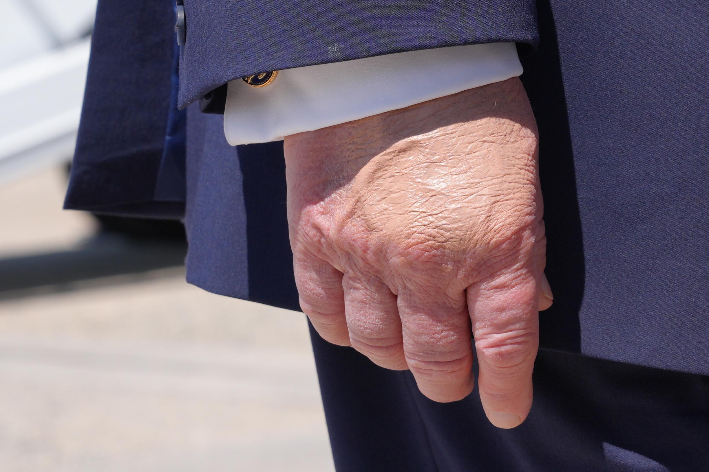 President Donald Trump's right hand is seen as he speaks to the press.