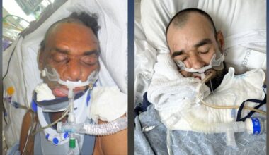 Los Angeles County hospitals need help finding families of 2 injured patients