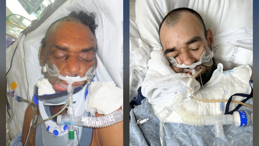 Los Angeles County hospitals need help finding families of 2 injured patients