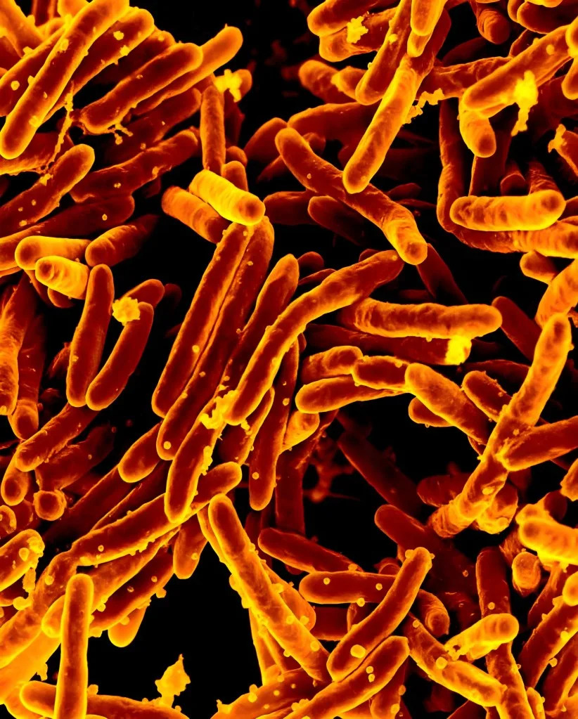 TB spreads through the air when someone with active tuberculosis coughs, speaks, sings, or breathes. BSIP/Universal Images Group via Getty Images