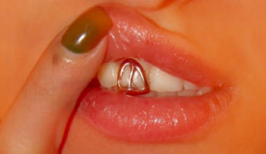 Iranian artist in San Francisco turns teeth into canvas with custom grill designs