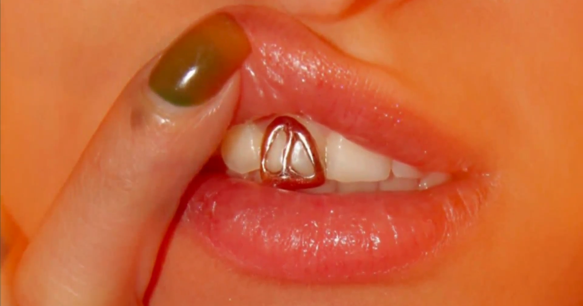 Iranian artist in San Francisco turns teeth into canvas with custom grill designs