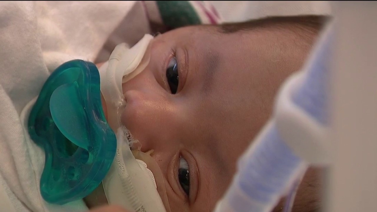 Santa Clara Valley Medical Center program addresses 'critical gap' in NICU services