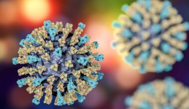 Two measles cases confirmed in San Diego County – NBC 7 San Diego