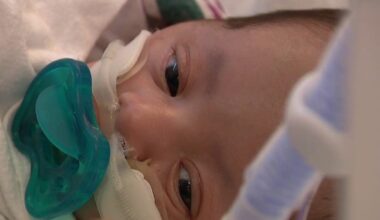 Santa Clara Valley Medical Center program tackles 'critical gap' in NICU mental health