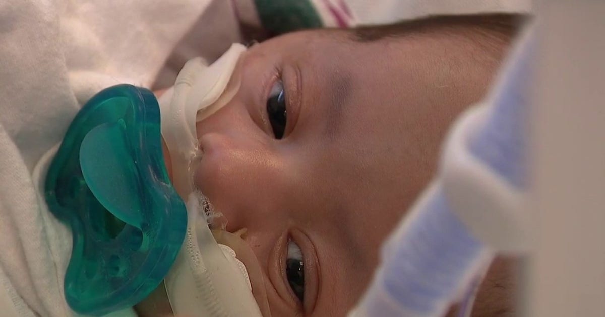 Santa Clara Valley Medical Center program tackles 'critical gap' in NICU mental health